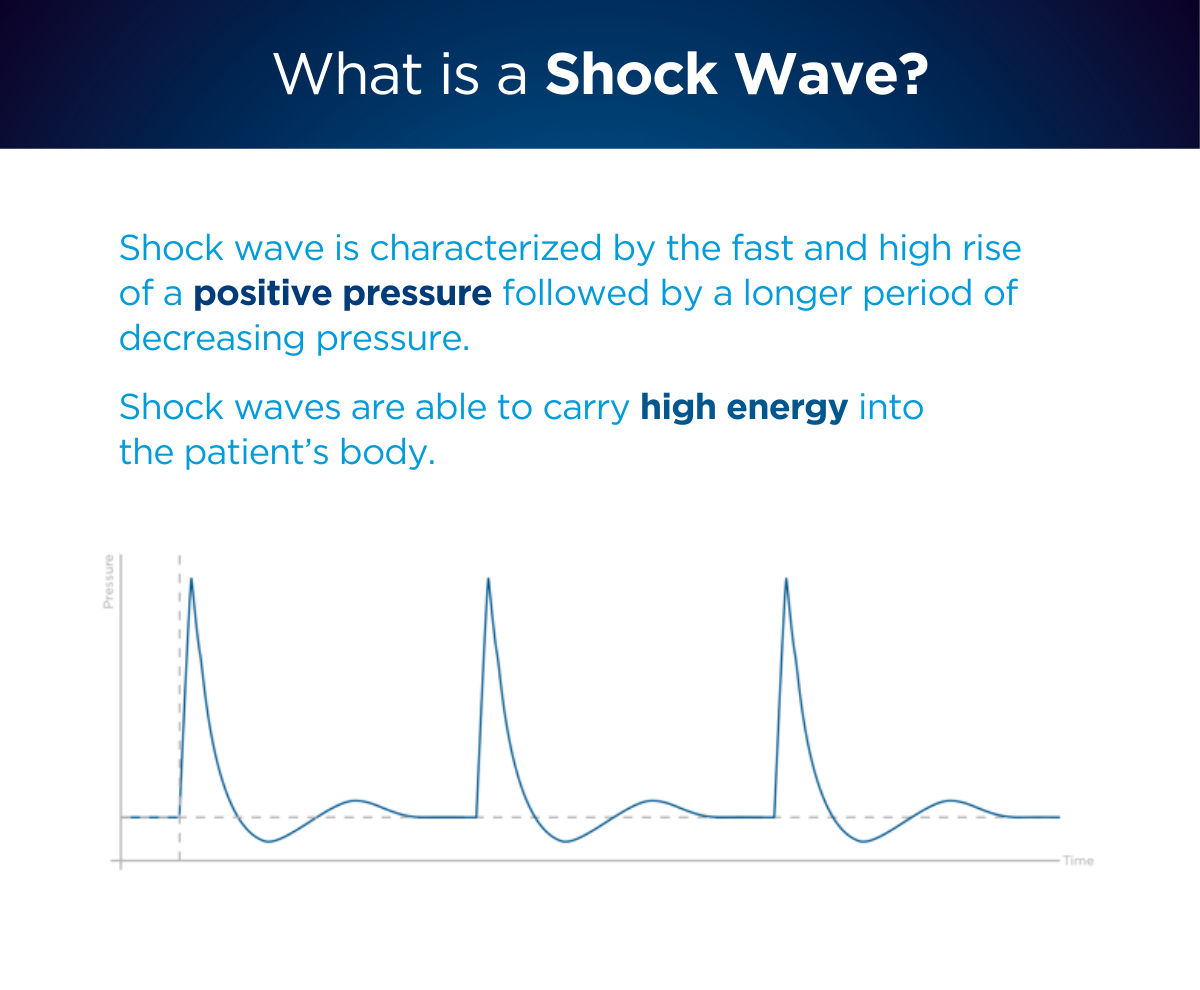 Shockwave Therapy